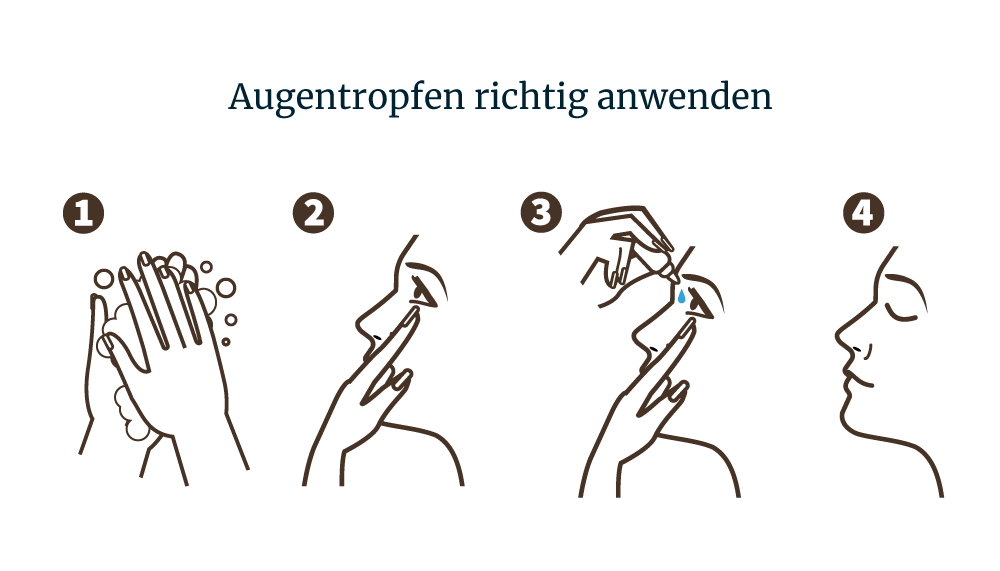 Augentropfen richtig anwenden