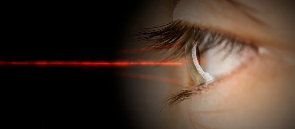 Laserbehandlung in Wien beim Augenarzt